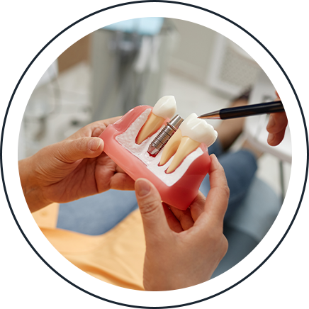 Dentist pointing to a model of a dental implant