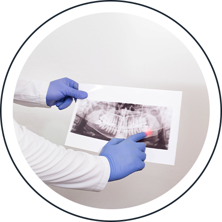 Dentist reviewing a dental X-ray showing a patient's teeth