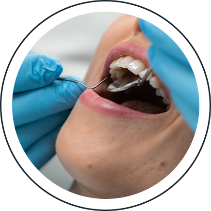 Dentist examining a patient's teeth during a general dentistry checkup