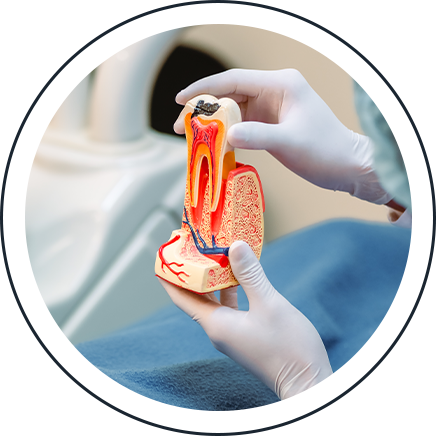 Dentist holding a cross-section tooth model illustrating a root canal