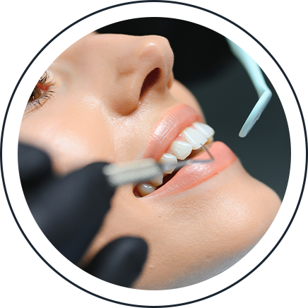 Close-up of a dental crown being fitted onto a patient's tooth
