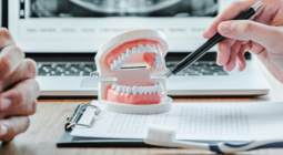 Dentist holding a model of teeth during a dental exam consultation