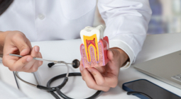 Dentist holding a cross-section tooth model showing the root canal